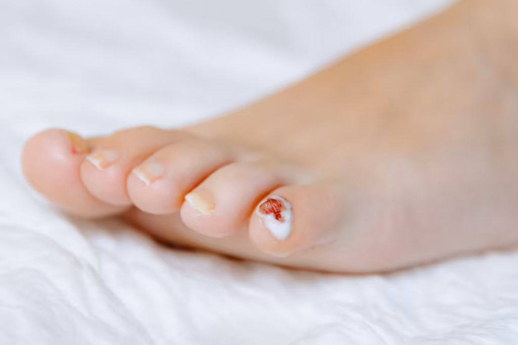 little finger with hydrogen peroxide on a woman s 2026 03 26 23 17 11 utc